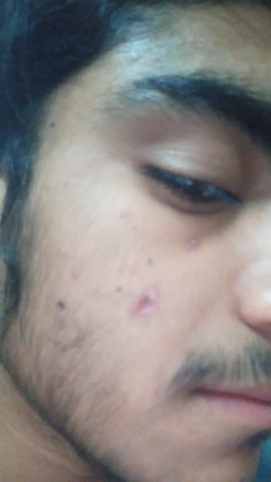 Customer before treatment